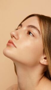 تزریق فیلر بینی جهت اصلاح فرم - بعد از درمان