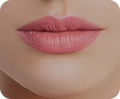 تزریق فیلر لب متد روسی - بعد از درمان